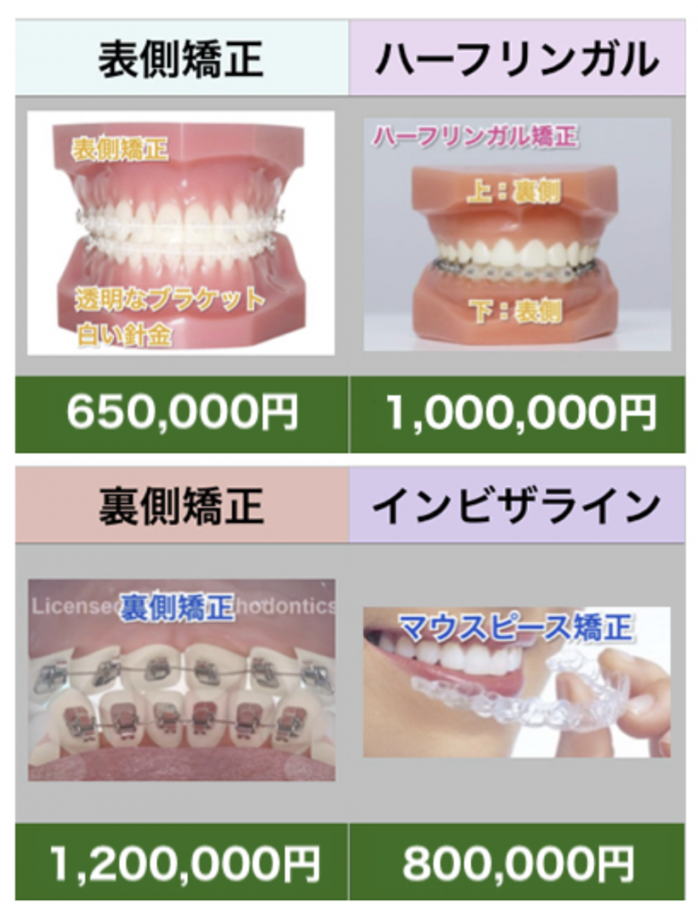 マウスピース矯正の治療費は高い 南千住の矯正歯科 南千住小児歯科矯正歯科 土日診療 南千住の矯正歯科専門医院 南千住小児歯科矯正歯科